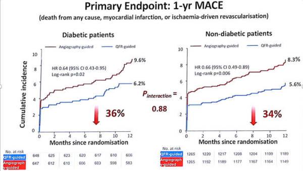 Angioplastie guidée par QFR versus angiographie simple chez le patient diabétique, sous étude de FAVOR III China