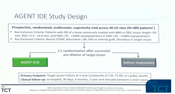 AGENT IDE figure 1