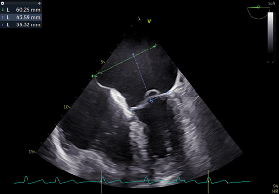 Le-coeur-a-ses-raisons-que-la-jugulaire-ne-connaît-point-figure8.jpg