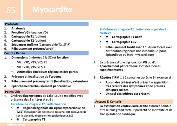 Fiche de synthèse : IRM cardiaque - 1