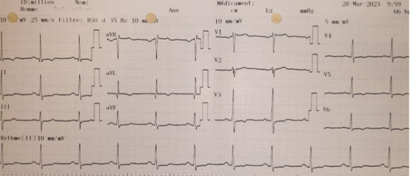 Electrocardiogramme