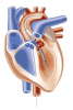 Choc cardiogénique avec assistance circulatoire figure2